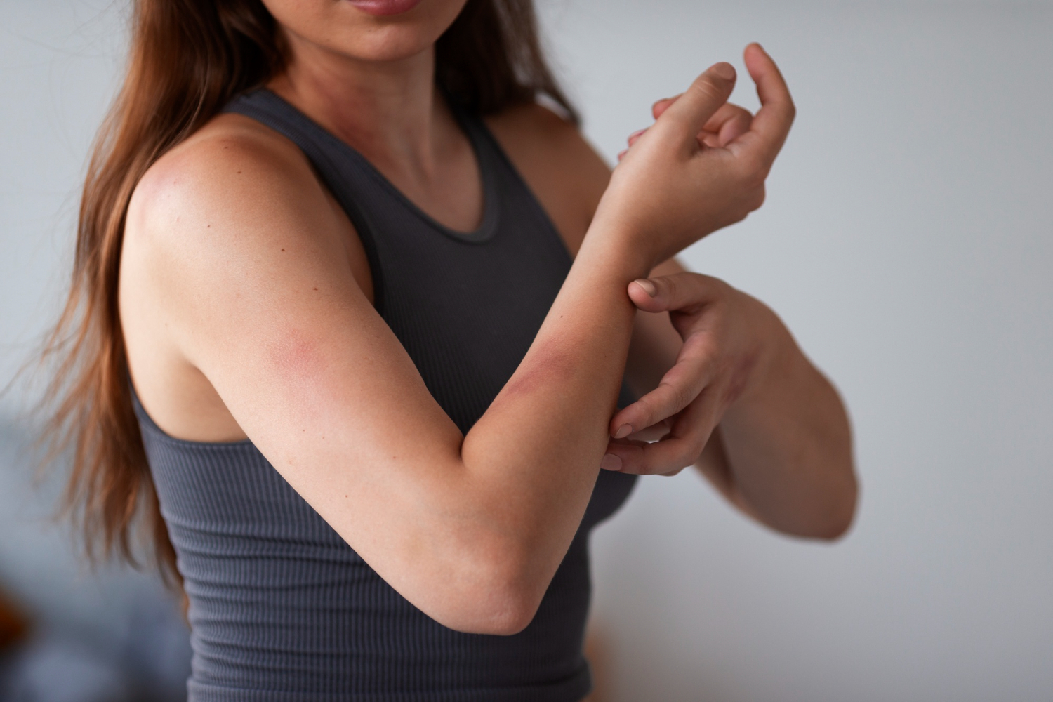 woman with rashes