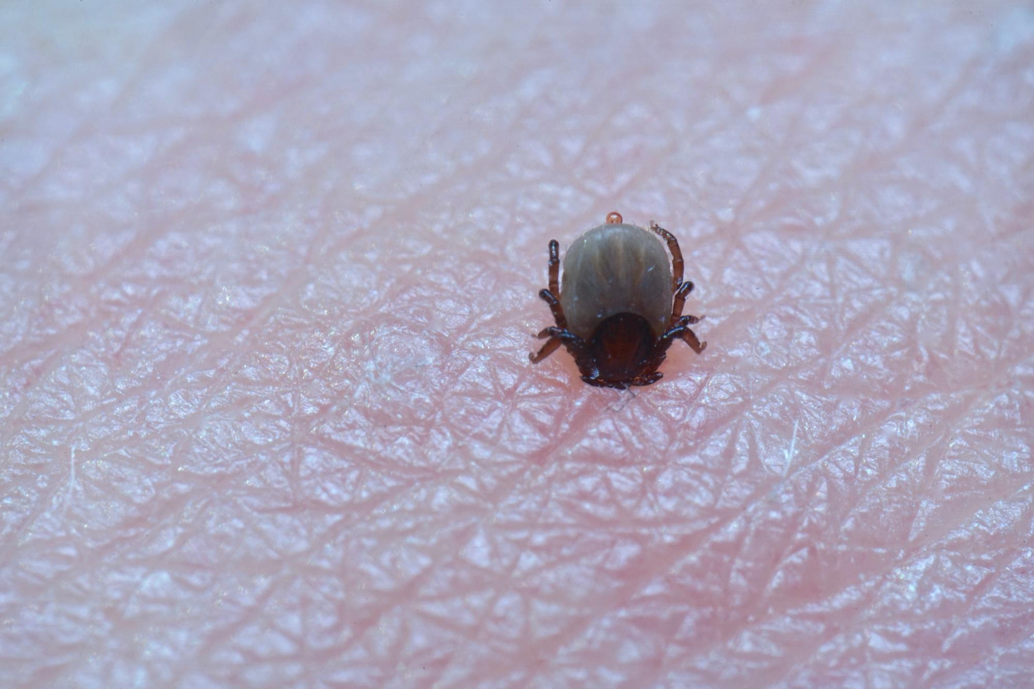 tickborne-disease-testing