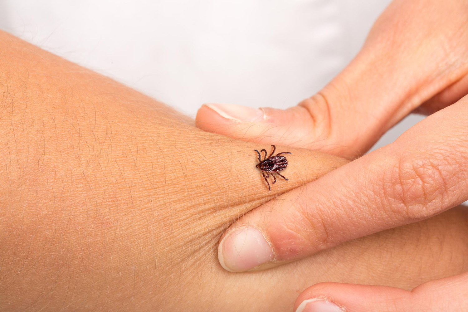 arm with a tick on top of it