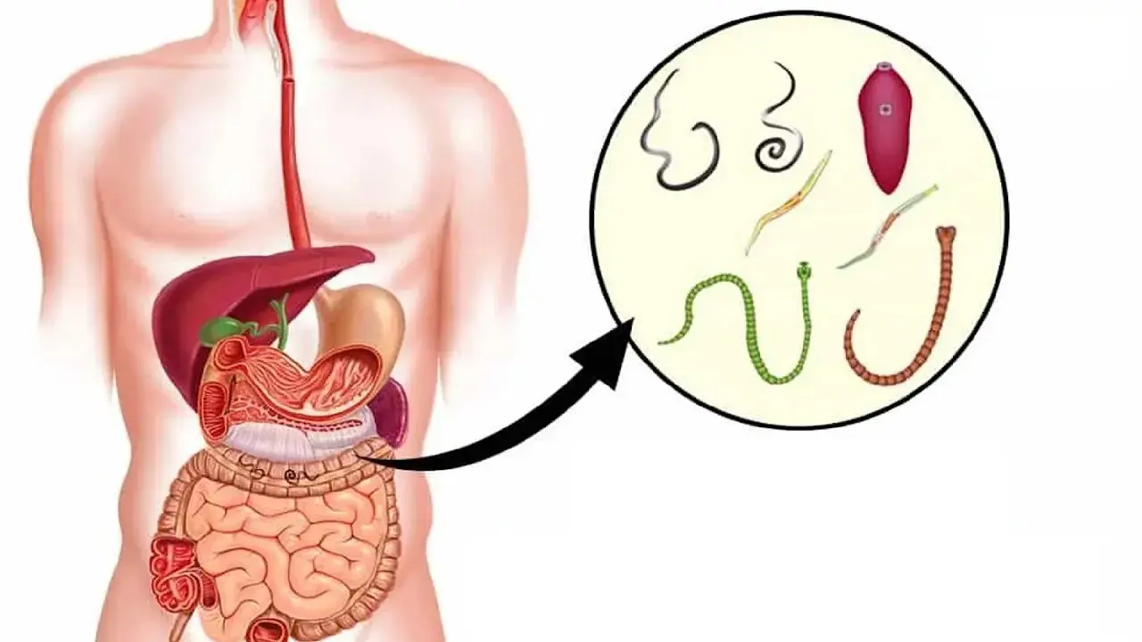 Signs You Need a Full Moon Parasite Cleanse Kit