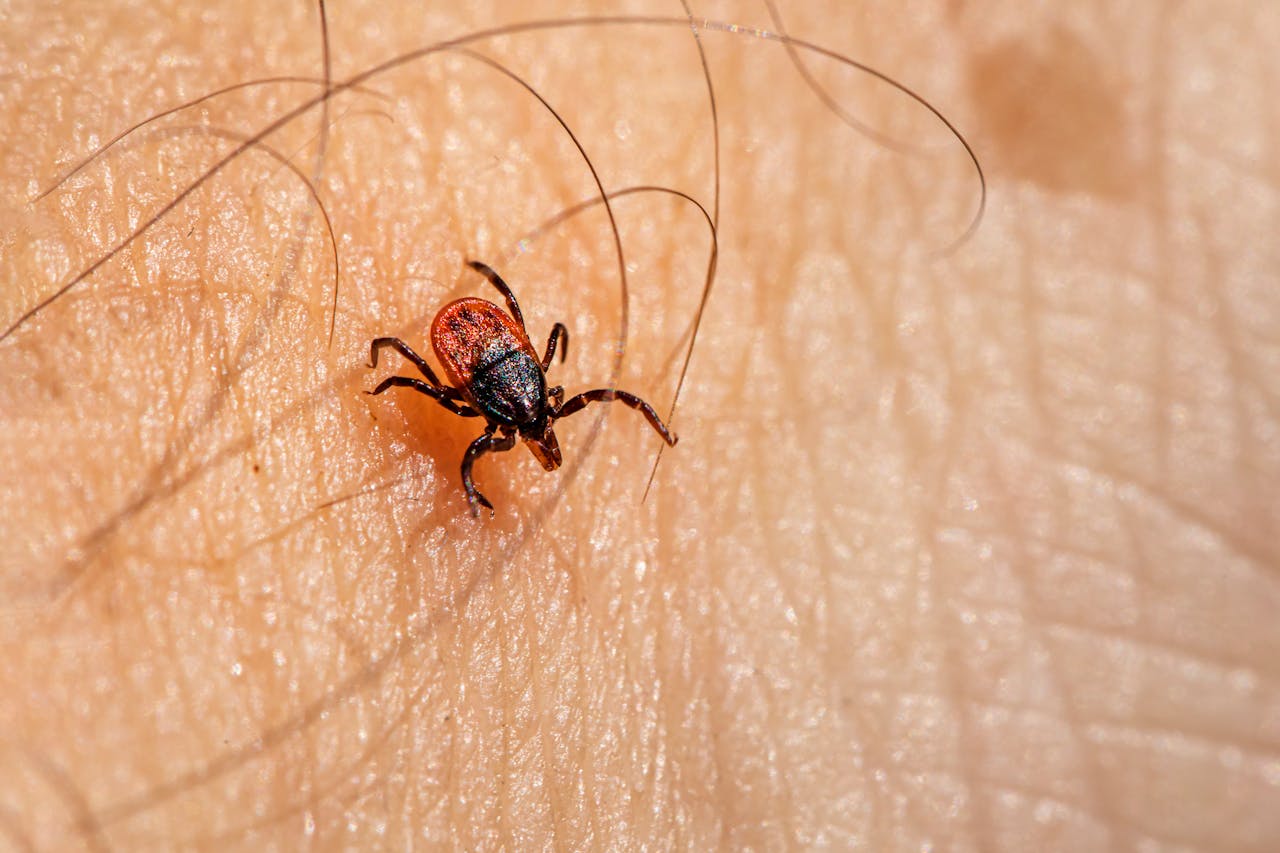 lyme disease
